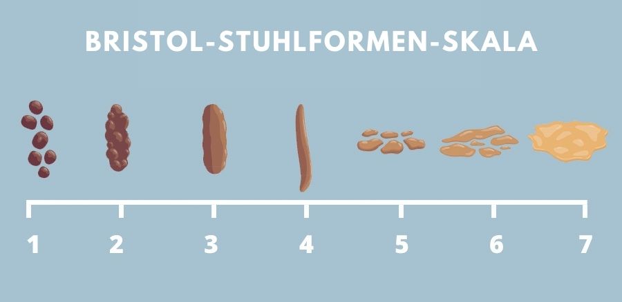 Bristol-Stuhlformen-Skala